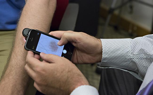 App kan hjälpa läkare bedöma hudcancer